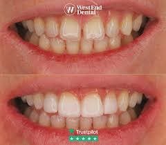 west end dental 06(1)